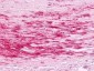 B1R / BDKRB1 Antibody (Cytoplasmic Domain)